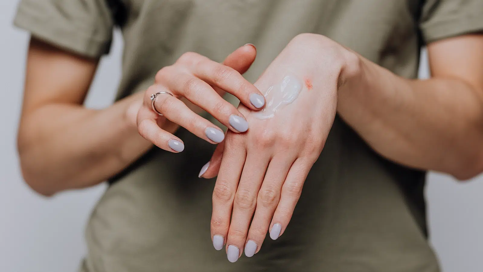 CBD Skincare For Eczema